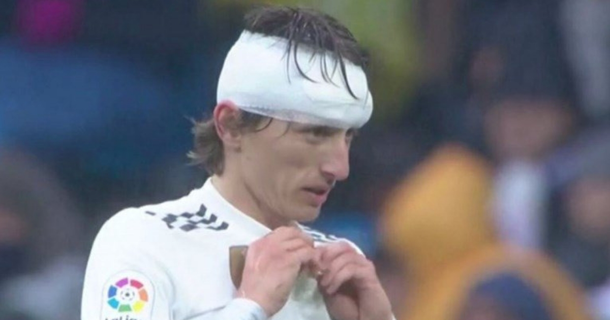 Pogledajte kako izgleda Luka Modrić poslije krvavog sudara